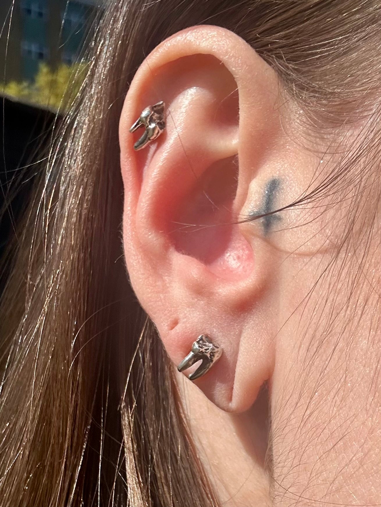 Tooth studs