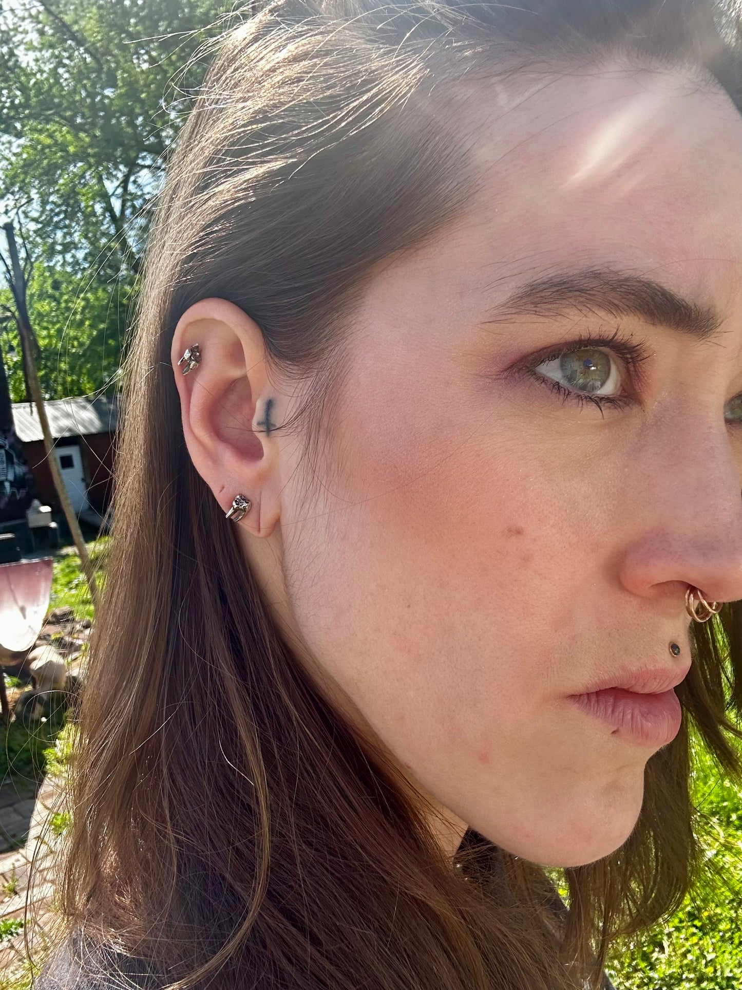 Tooth studs